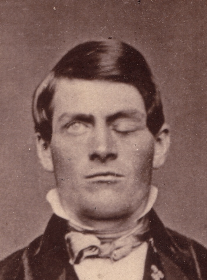 Buy essay online cheap phineas gage and the role of the brain in cognitive functioning